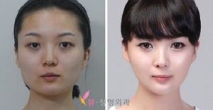 La Corée du Sud : championne en chirurgie plastique